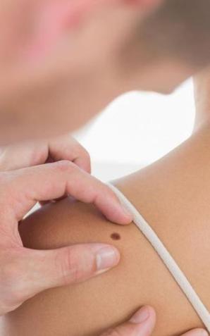 Jawor: Akademia Czerniaka - dowiedz się, jak się przed nim chronić